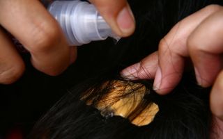 Как убрать жвачку с волос в домашних условиях: средства, чтобы достать жевательную резинку с головы ребенка