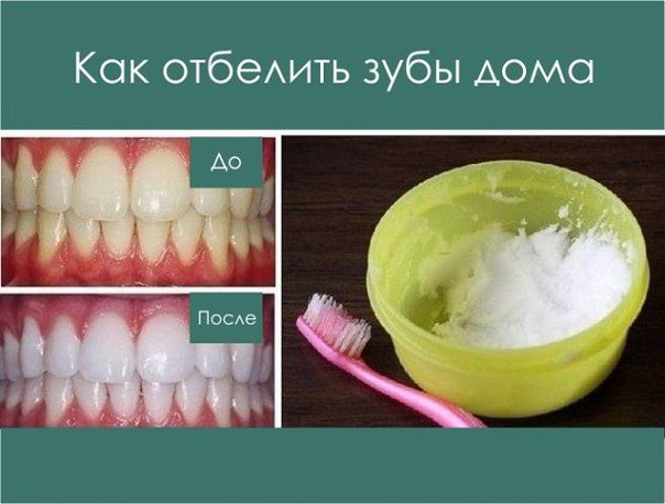 Отбеливание зубов перекисью и содой отзывы pro 110 ингалятор